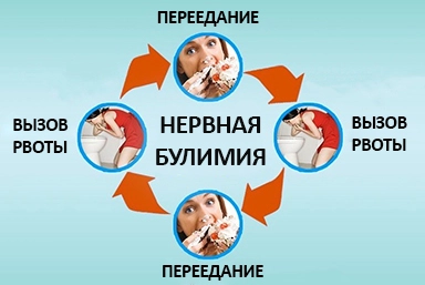 Лечение булимии в Севастополе